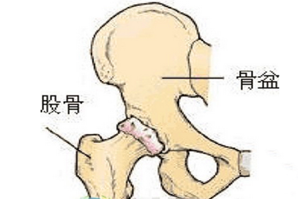 股骨头与骨质疏松