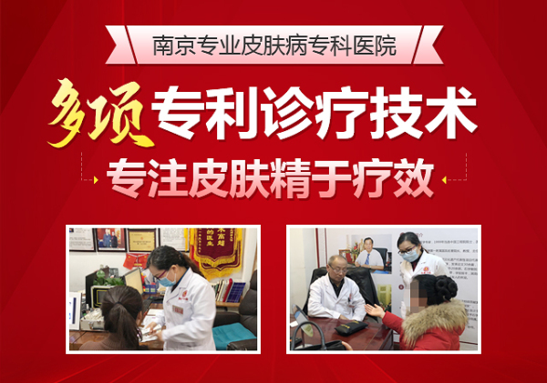 南京治疗湿疹比较好的地方 南京肤康皮肤病研究所