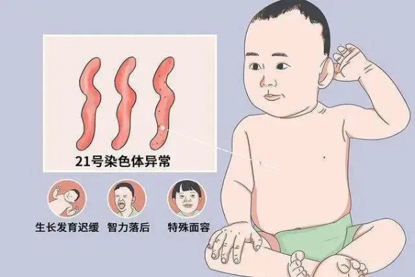 天津坤如玛丽医院：每20分钟就有一个唐氏儿出生!孕妈妈产前筛查必不可少!